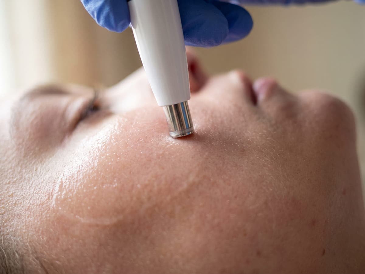 Skin Renewal